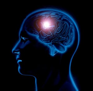 آلزایمر